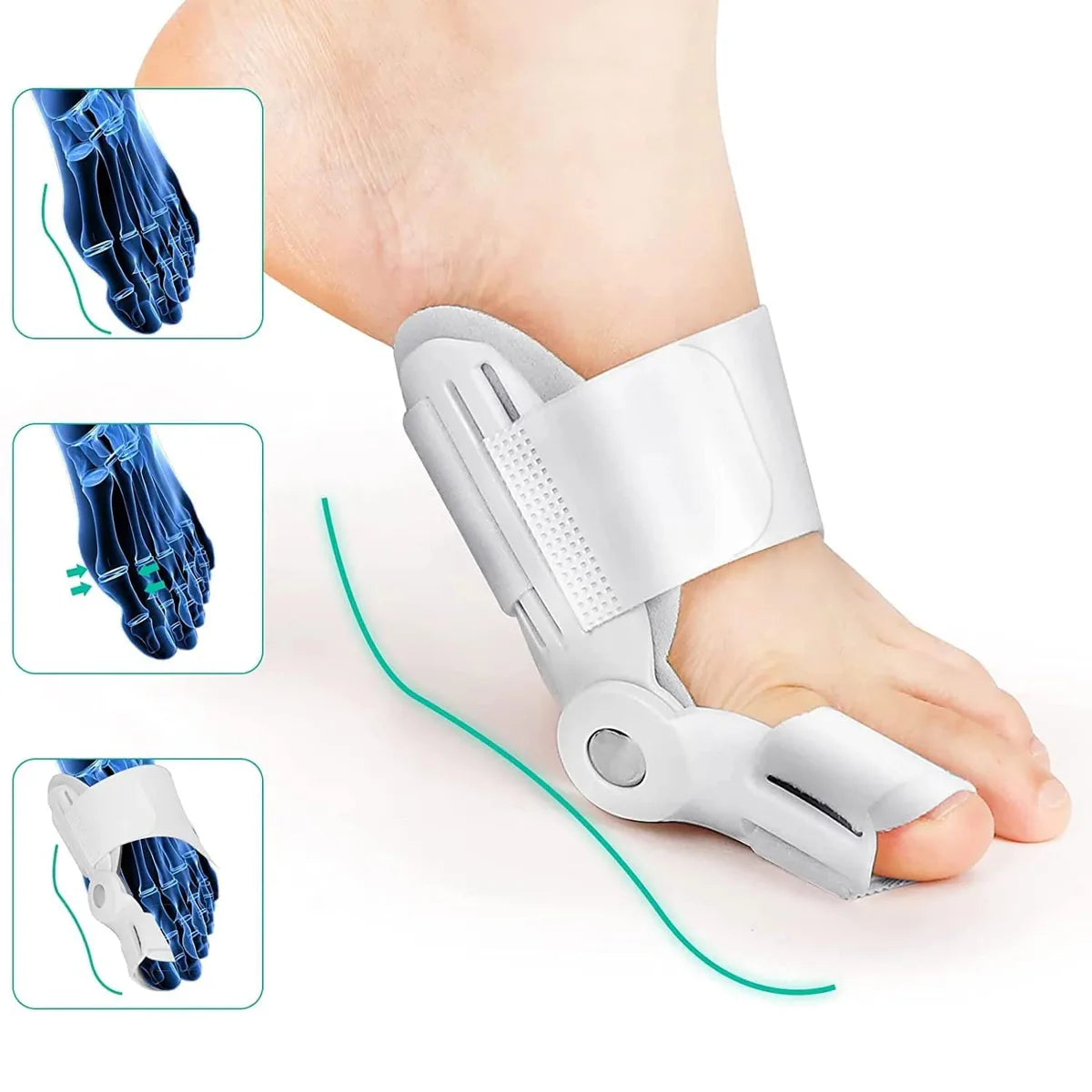 Toe Straightener - Free Size